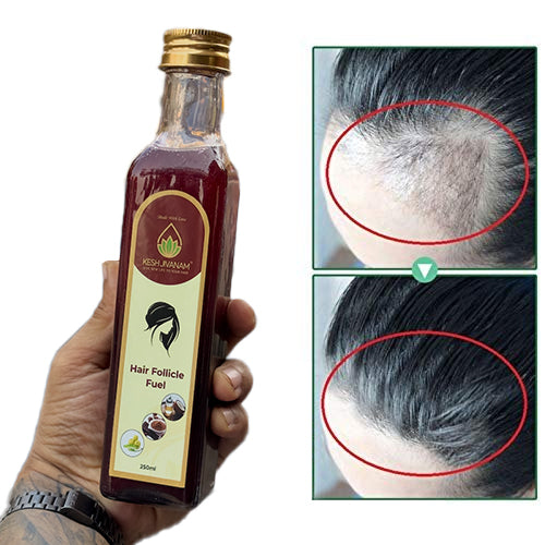 Keshjivanam Hair Follicle Fuel – Hair Fall & Thinning Solution
