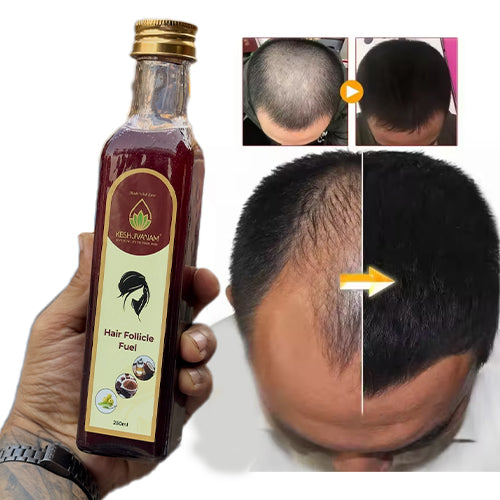 Keshjivanam Hair Follicle Fuel – Hair Fall & Thinning Solution