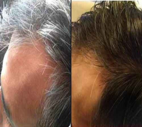 Pack of 2 KeshJivanam Black Velvet Botanics – FREE Hair Cleansing Agent (BUY 2 GET 1 FREE)