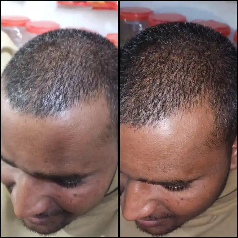 Pack of 2 KeshJivanam Black Velvet Botanics – FREE Hair Cleansing Agent (BUY 2 GET 1 FREE)